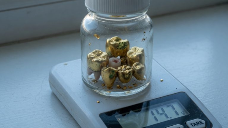 Ugly dental gold crowns in a small jar on a digital scale